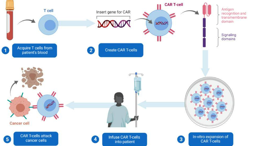 O que são células CAR-T?