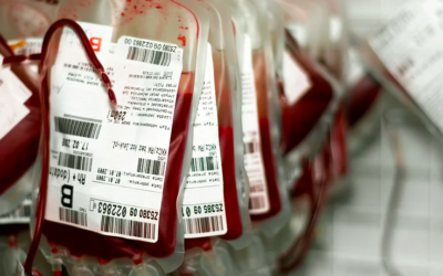 Porque utilizamos transfusão de hemácias fenotipadas?