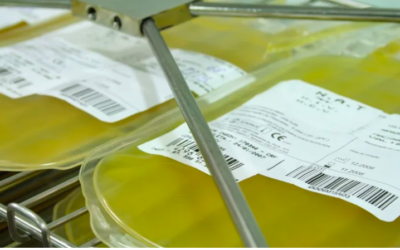 A transfusão de plaquetas é indicada no tratamento de pacientes com AVCh em uso de antiplaquetários?