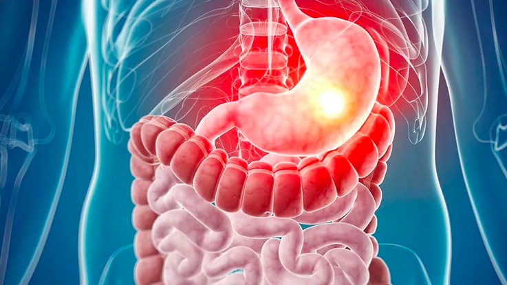 Qual a melhor estratégia transfusional em pacientes com hemorragia digestiva alta?